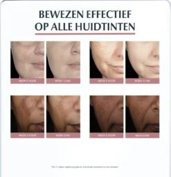 Eucerin Anti-Pigment Spotcorrector - Concealer - 5 Ml -Poeder - Foundation Winkel 1157x1200