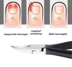 Medies - Professionele Zware Nageltang Voor Teennagels | Nagelknipper Teennagels | Ingegroeide Teennagel | Kalknagel | Harde Teennagels | Nagelschaar | Pedicure - Ingebouwde Veren -Poeder - Foundation Winkel 1200x1113 5