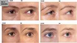 L'Oréal Paris Clinically Proven Wimperserum - 2 Ml -Poeder - Foundation Winkel 1200x670 2